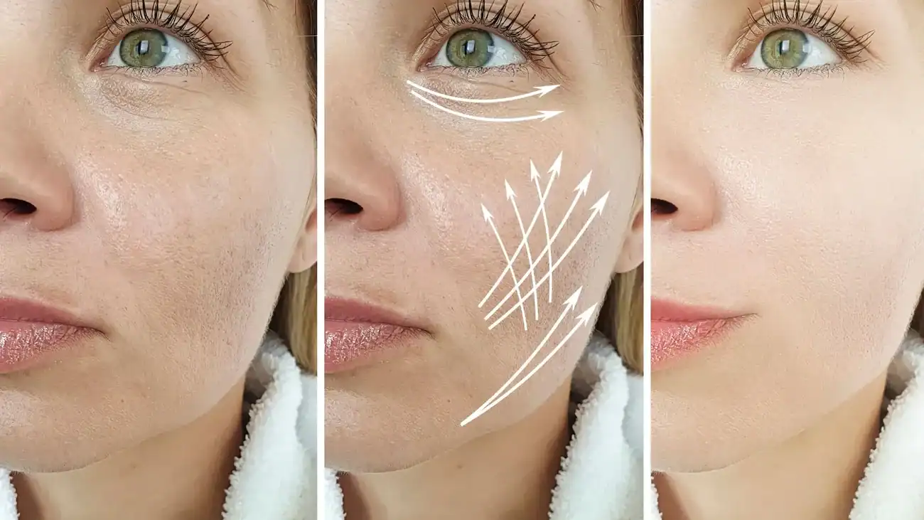 Can One Treatment Really Tackle More Than One Skin Concern Bradford?